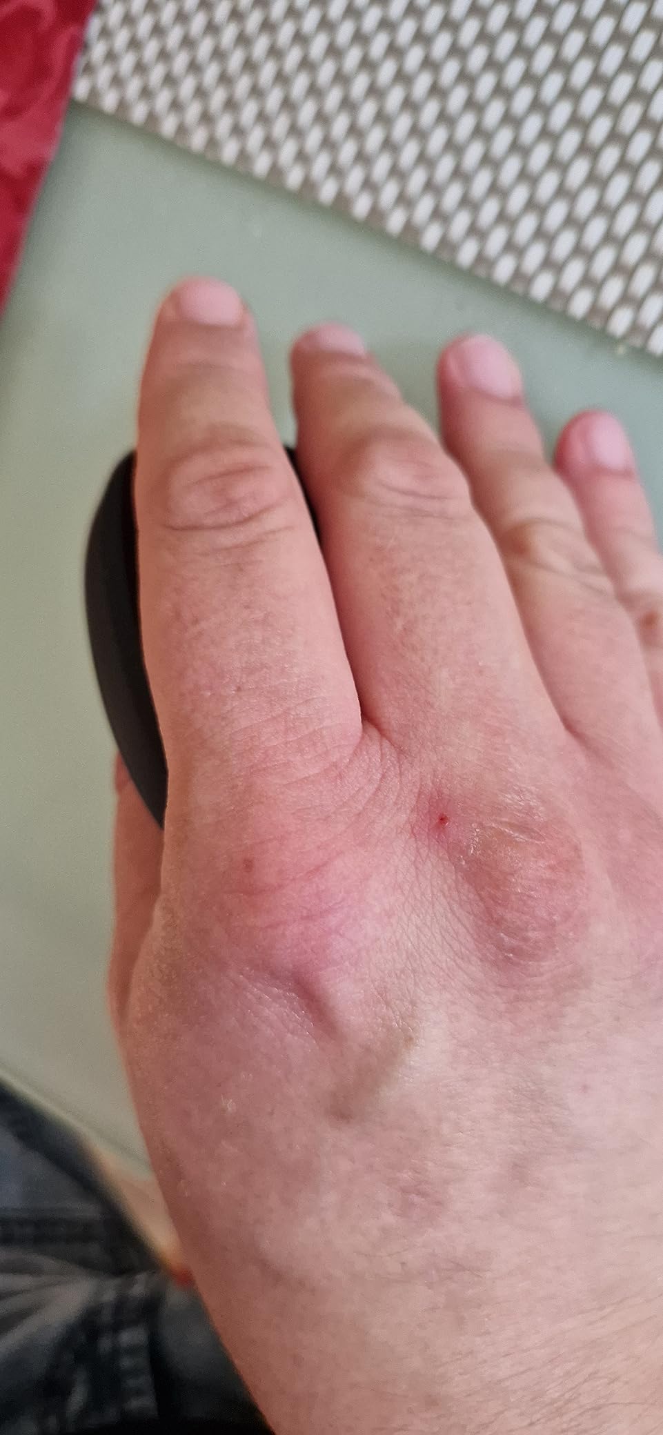 Hilft gegen Tennisarm
